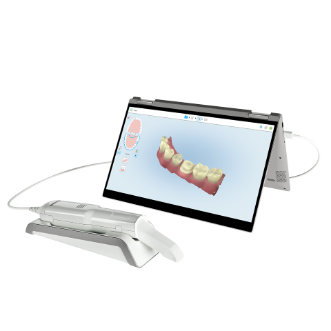 iTero Digital Dental Impressions make it easier for dental implants